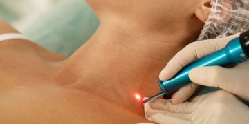 Hospital AmericanCor adota laserterapia