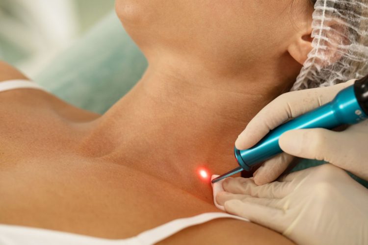 Hospital AmericanCor adota laserterapia