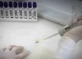 suspeito de ebola em SP