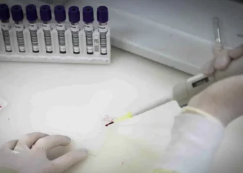 suspeito de ebola em SP