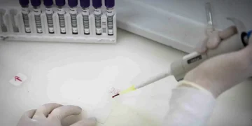 suspeito de ebola em SP