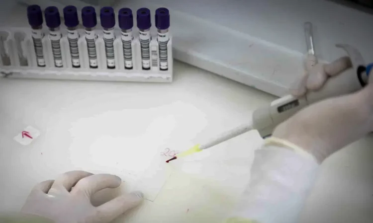 suspeito de ebola em SP